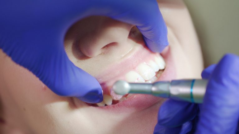 000301-120400-yj9-as3qob_PMNW