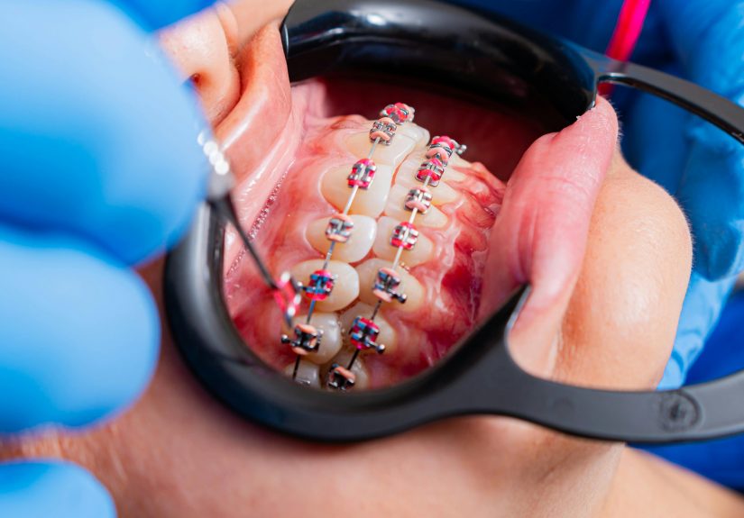 pexels-diego-romero-471613950-19147369