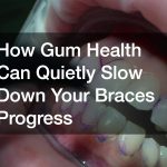 How Gum Health Can Quietly Slow Down Your Braces Progress